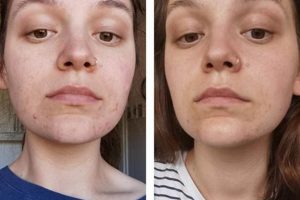 Unlocking Vegan Diet Skin: Glow From Within + Tips Discover Delicious Vegan Food, Beauty Swaps, and Zero-Waste Tips for a Greener Life Unlocking Vegan Diet Skin: Glow From Within + Tips | Discover Delicious Vegan Food, Beauty Swaps, and Zero-Waste Tips for a Greener Life