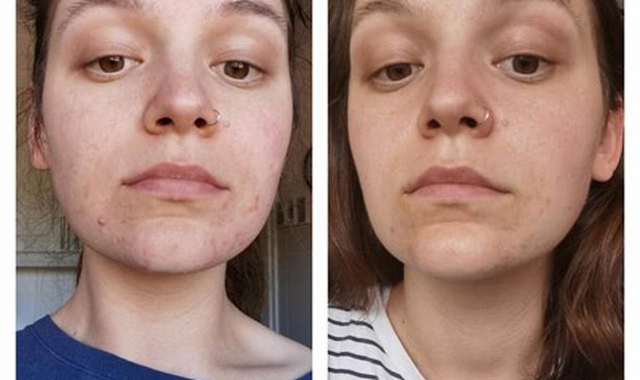 Unlocking Vegan Diet Skin: Glow From Within + Tips Discover Delicious Vegan Food, Beauty Swaps, and Zero-Waste Tips for a Greener Life Unlocking Vegan Diet Skin: Glow From Within + Tips | Discover Delicious Vegan Food, Beauty Swaps, and Zero-Waste Tips for a Greener Life
